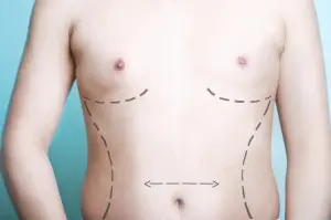 Plastic Surgery in Nashville, TN