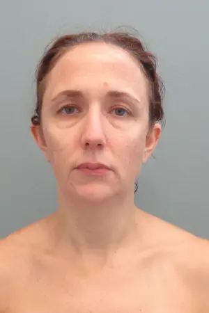 Rhinoplasty Before & After Pictures in Nashville, TN