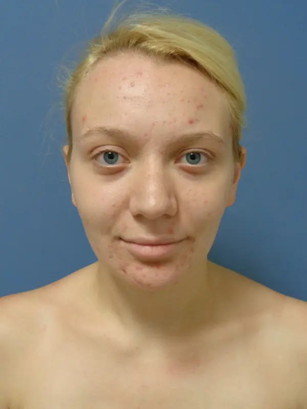 Before & After Pictures in Nashville, TN