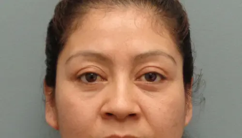Blepharoplasty Before & After Pictures in Nashville, TN