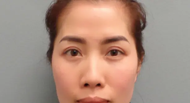 Blepharoplasty Before and After Pictures in Nashville, TN