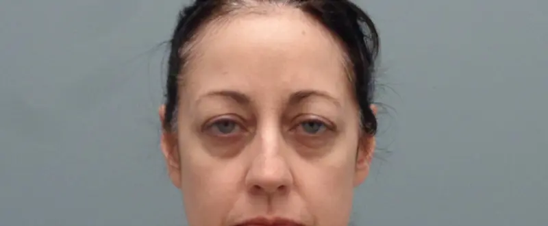 Blepharoplasty Before and After Pictures Nashville, TN