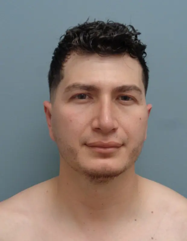 Rhinoplasty Before and After Pictures Nashville, TN