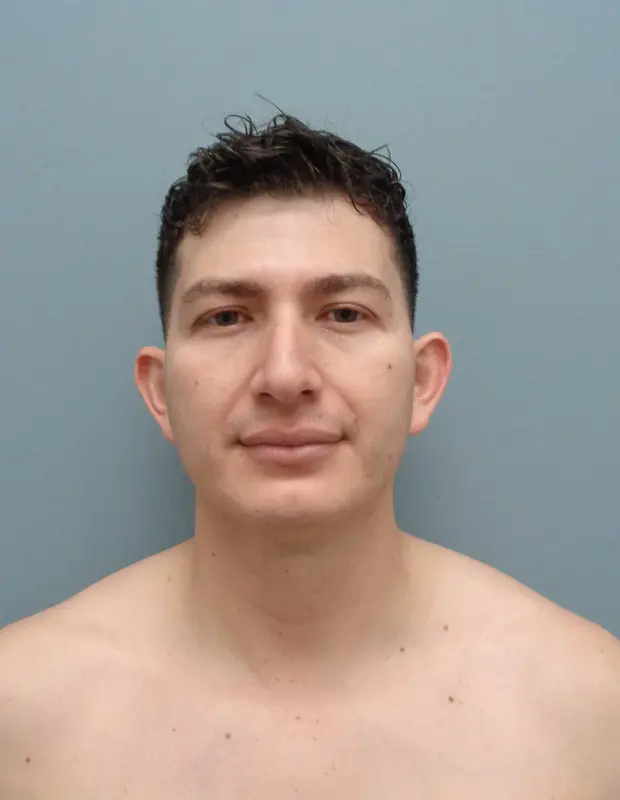 Rhinoplasty Before and After Pictures Nashville, TN