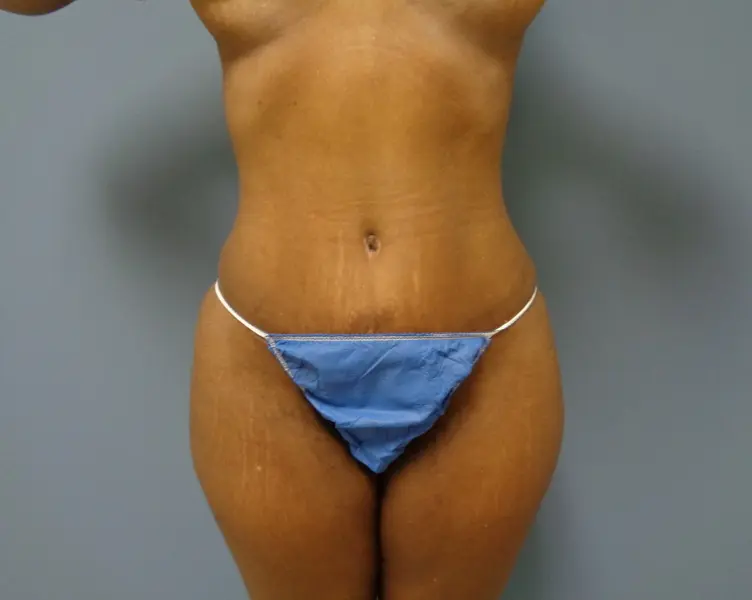 Before & After Pictures in Nashville, TN