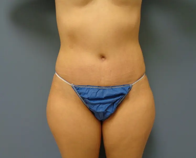 Before & After Pictures in Nashville, TN