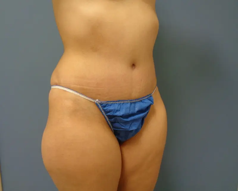 Before & After Pictures in Nashville, TN