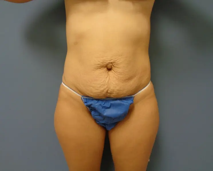 Before & After Pictures in Nashville, TN