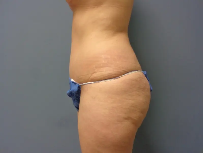 Before & After Pictures in Nashville, TN
