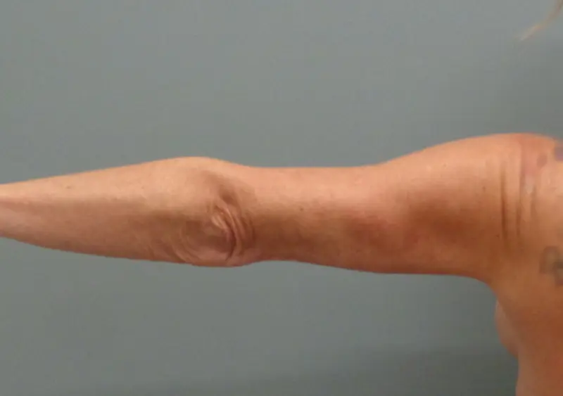 Before & After Pictures in Nashville, TN