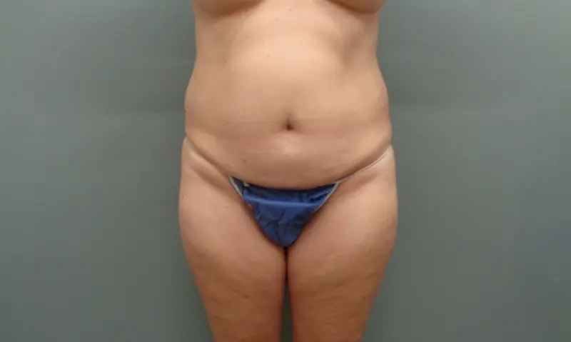 Before & After Pictures in Nashville, TN