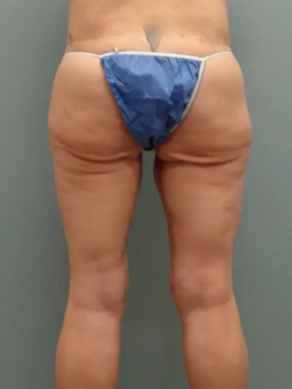 Before & After Pictures in Nashville, TN