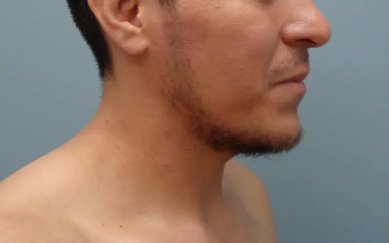 Before & After Pictures in Nashville, TN