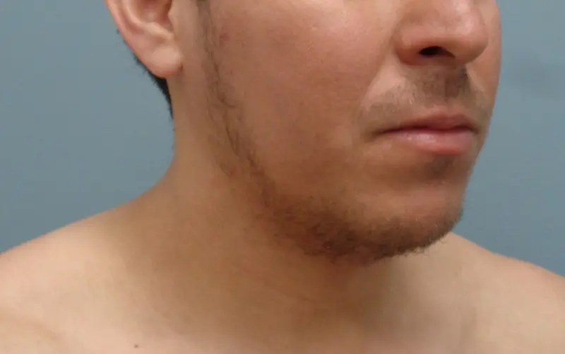 Before & After Pictures in Nashville, TN
