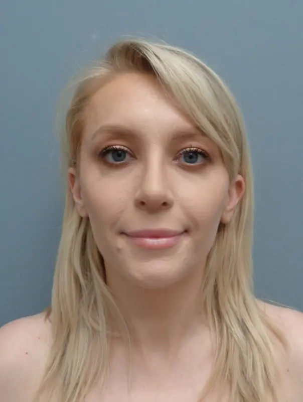Before & After Pictures in Nashville, TN