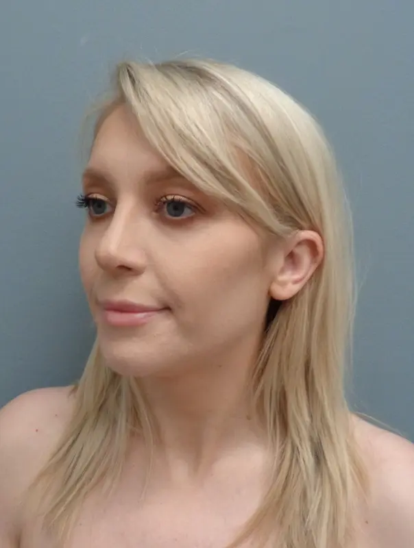 Before & After Pictures in Nashville, TN