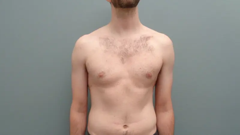 Before & After Pictures in Nashville, TN