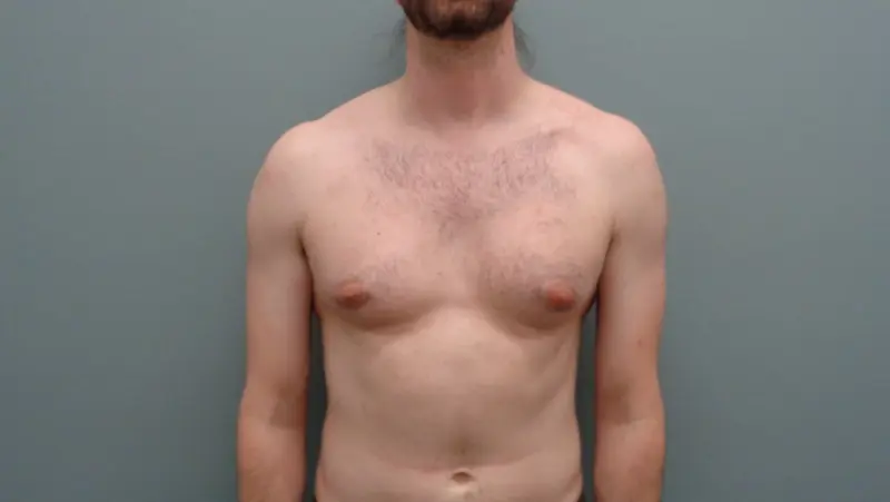 Before & After Pictures in Nashville, TN