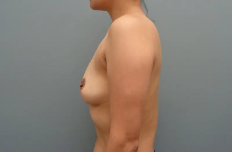 Before & After Pictures in Nashville, TN