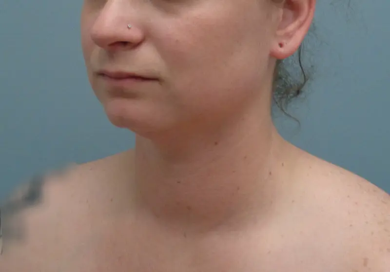 Before & After Pictures in Nashville, TN