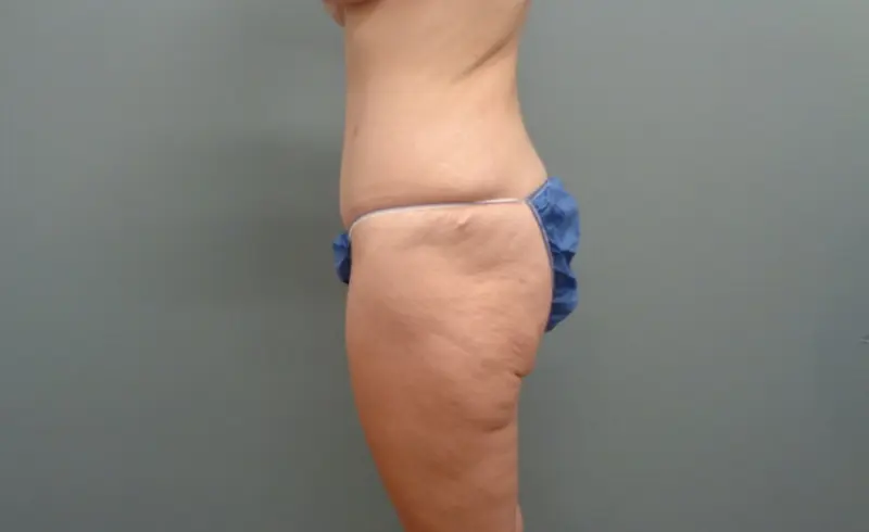 Before & After Pictures in Nashville, TN