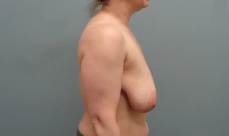Before & After Pictures in Nashville, TN