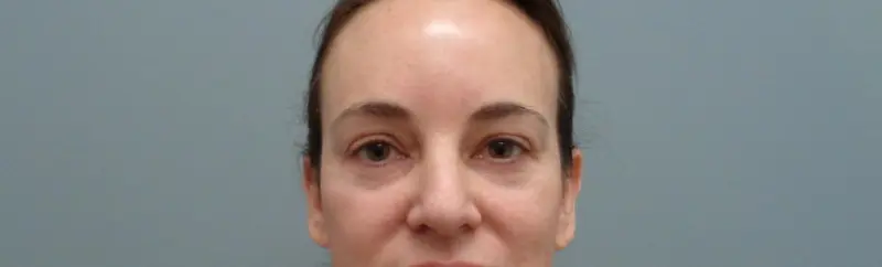 Before & After Pictures in Nashville, TN