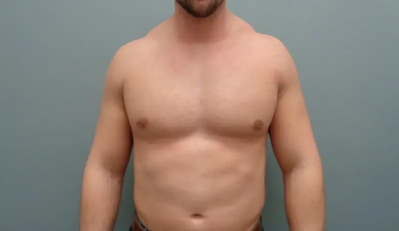 Before & After Pictures in Nashville, TN