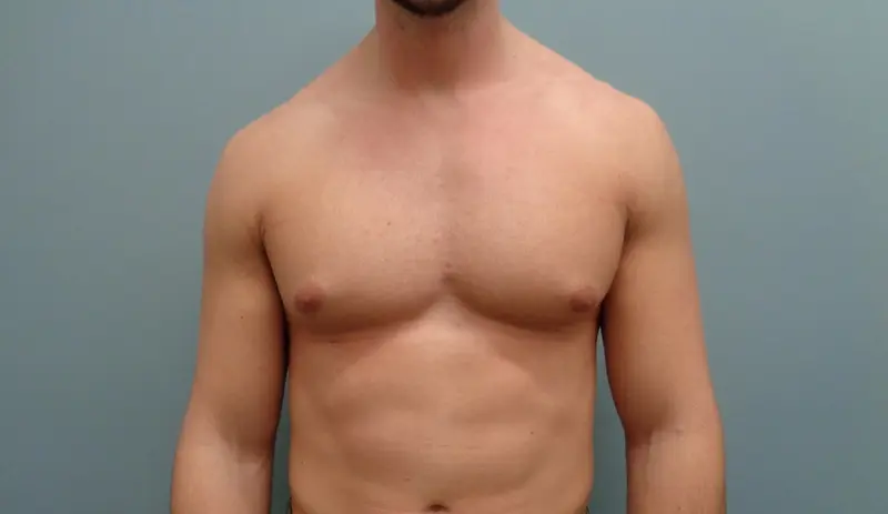 Before & After Pictures in Nashville, TN