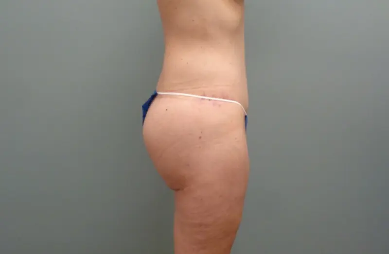 Before & After Pictures in Nashville, TN