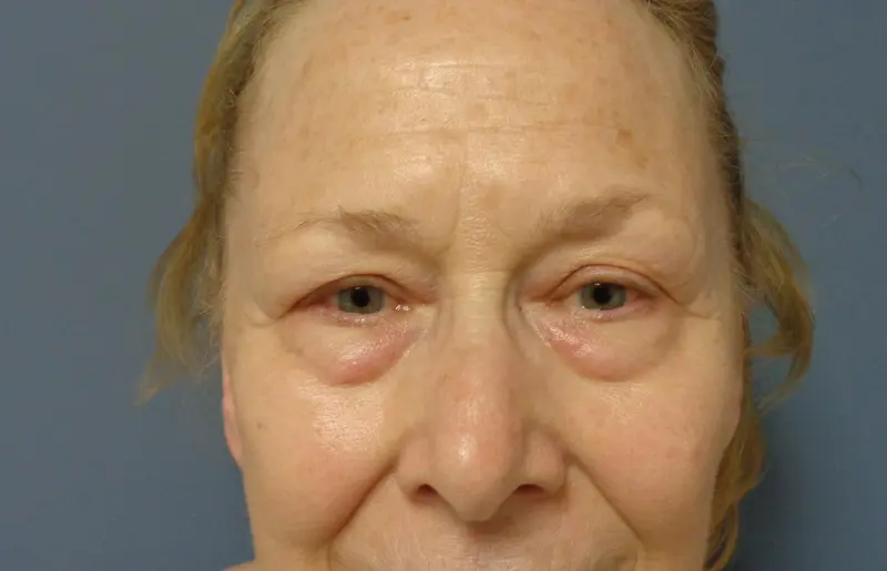 Before & After Pictures in Nashville, TN