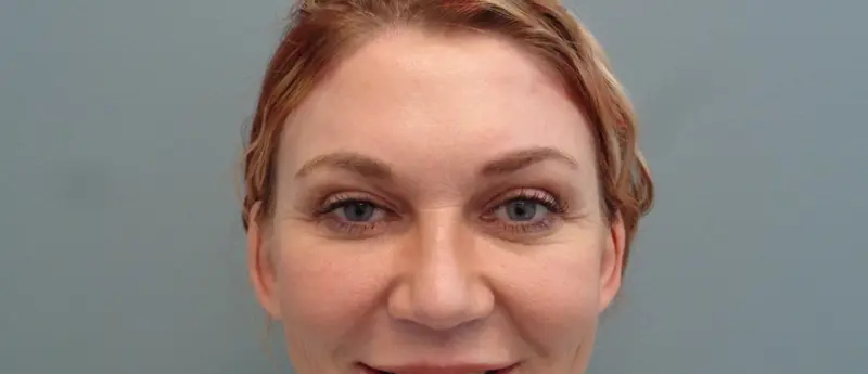 Before & After Pictures in Nashville, TN