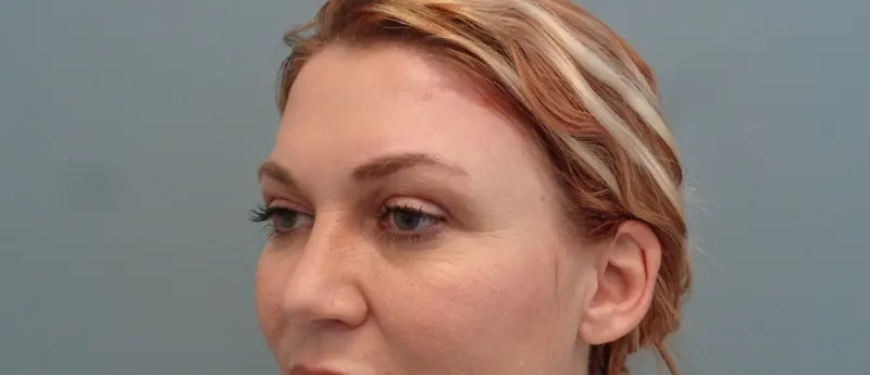 Before & After Pictures in Nashville, TN