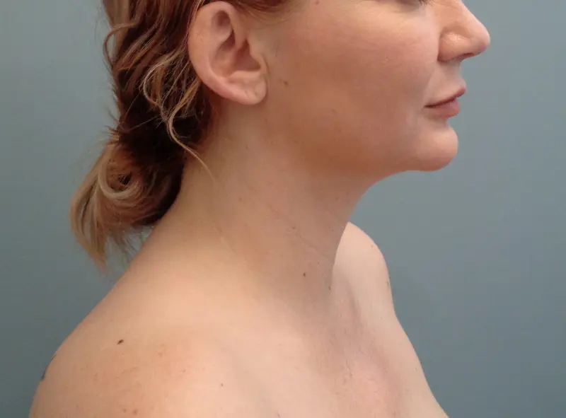 Before & After Pictures in Nashville, TN