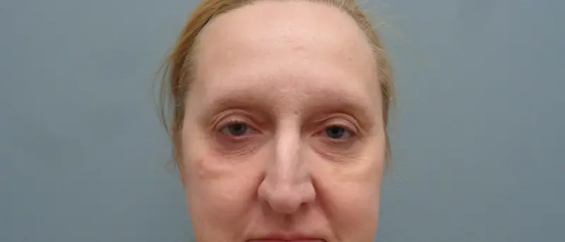 Before & After Pictures in Nashville, TN