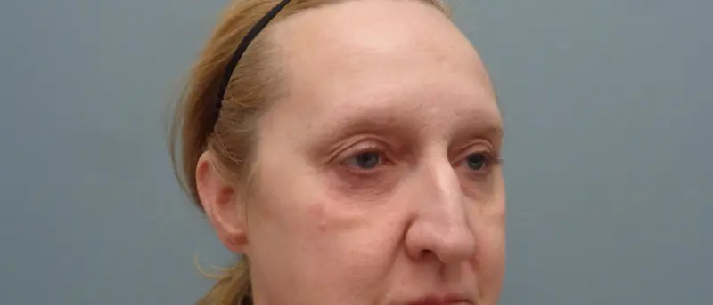 Before & After Pictures in Nashville, TN