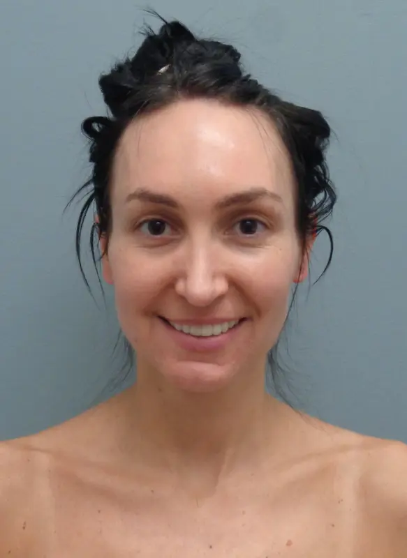 Before & After Pictures in Nashville, TN