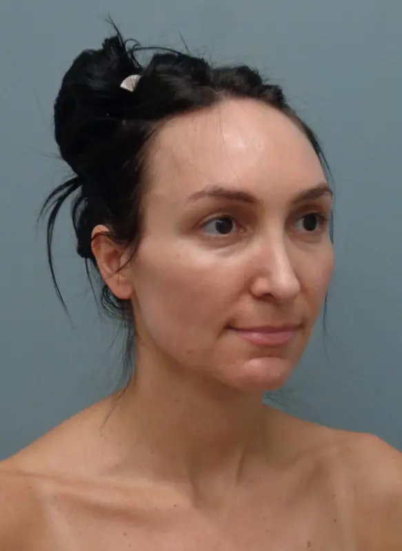 Before & After Pictures in Nashville, TN