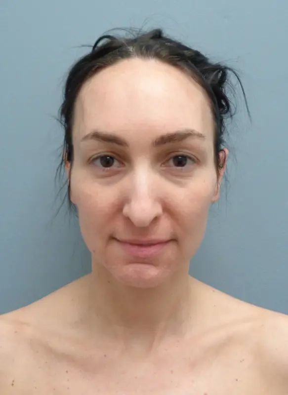 Before & After Pictures in Nashville, TN