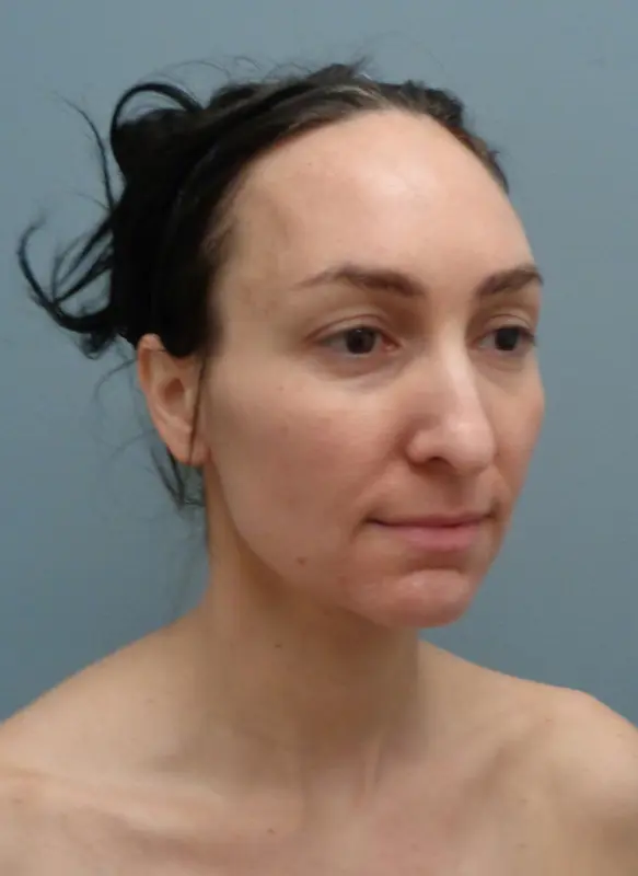Before & After Pictures in Nashville, TN