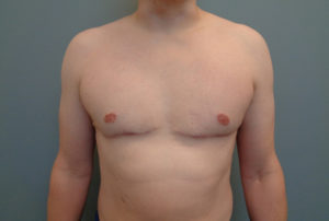 Before & After Pictures in Nashville, TN
