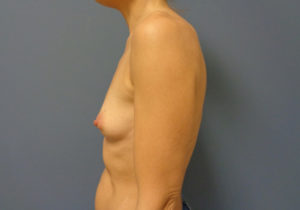 Before & After Pictures in Nashville, TN