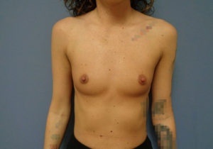 Before & After Pictures in Nashville, TN