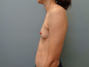 Before & After Pictures in Nashville, TN