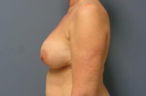 Before & After Pictures in Nashville, TN