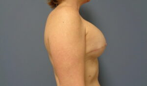 Before & After Pictures in Nashville, TN