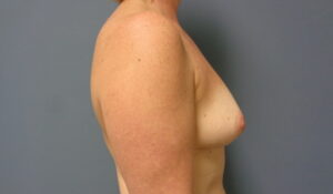 Before & After Pictures in Nashville, TN
