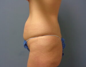 Before & After Pictures in Nashville, TN