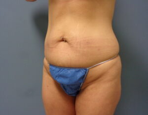 Before & After Pictures in Nashville, TN