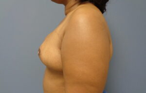Before & After Pictures in Nashville, TN